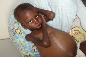 haiti starving children