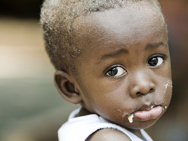 malawi starving children